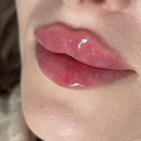 جشنواره لب فیلر ژل روسی بوتاکس زاویه سازی مادلینگ|خدمات آرایشگری و زیبایی|کرج, گوهردشت|دیوار