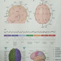 دستگاه نوروفیدبک و نقشه مغزی ۲۴ کاناله (QEEG)|آرایشی، بهداشتی، درمانی|تهران, پامنار|دیوار