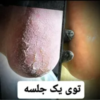 اموزش حرفه پدیکور خشک و خیس
