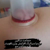 حجامت رفع مشکلات کبدی تیرگی پوست خستگی و غلظت خون|خدمات آرایشگری و زیبایی|ایلام, |دیوار
