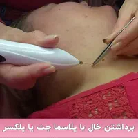 آموزش پلکسر