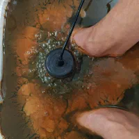 سمزدایی بدن