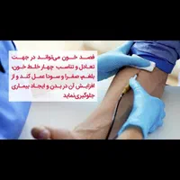 زالو درمانی تخصصی فصد حجامت پی آر پی جوانسازی فیلر|خدمات آرایشگری و زیبایی|اصفهان, محمودآباد|دیوار
