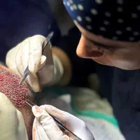 کاشت مو و ابرو تخصصی در یزد
