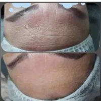فشیال پاکسازی آموزش تخصصی درمانی همراه مدرک|خدمات آموزشی|تهران, خرمشهر|دیوار