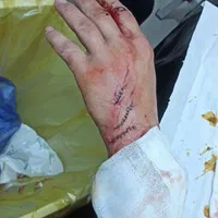 خدمات پزشکی پرستاری درمنزل شهریار،اندیشه،ملارد،قدس|خدمات آرایشگری و زیبایی|شهریار, |دیوار