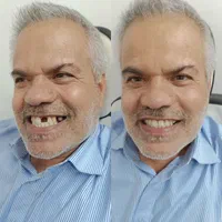 خدمات دندان مصنوعی|خدمات آرایشگری و زیبایی|اصفهان, ارداجی|دیوار