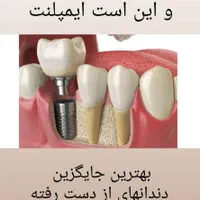 ایمپلنت دندان لمینت کامپوزیت دندانپزشکی|خدمات آرایشگری و زیبایی|اصفهان, هفتون|دیوار