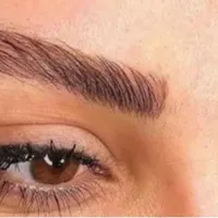 ژل و بوتاکس و مزو سر و صورت|خدمات آرایشگری و زیبایی|کوهدشت, |دیوار