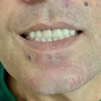 دندان مصنوعی(اقساطی)دندانسازی|خدمات آرایشگری و زیبایی|ارومیه, |دیوار