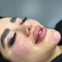 فیلر و ژل و بوتاکس مادلینگ فول فیس لیزرموهای زائد|خدمات آرایشگری و زیبایی|تهران, نازی‌آباد|دیوار