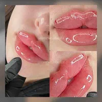 جشنواره تخفیفات ویژه ژل وبوتاکس