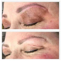 کلینیک زیبایی وفشیال|خدمات آرایشگری و زیبایی|گلستان (تهران), |دیوار