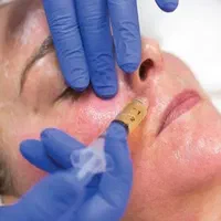 لیزر موی زاید بوتاکس هایفو ژل پی ارپی فشیال|خدمات آرایشگری و زیبایی|تهران, هاشمی|دیوار
