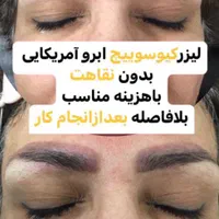لیزر co2 فراکشنال و هایفوی پزشکی نه رومیزی|خدمات آرایشگری و زیبایی|اهواز, کیانپارس |دیوار