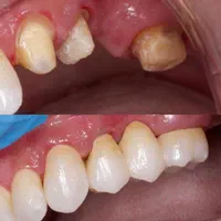 دندانسازی|خدمات آرایشگری و زیبایی|اهواز, کیانپارس |دیوار