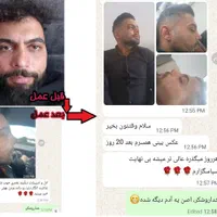 عمل جراحی بینی بامتخصص گوش،حلق،بینی|خدمات آرایشگری و زیبایی|تهران, ونک|دیوار