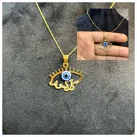 چشم نظر با جمله محلی