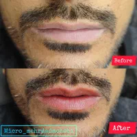 میکروبلیدینگ آقایان شیدینگ لب آقایان اسکالپ سر|خدمات آرایشگری و زیبایی|اصفهان, مرداویج|دیوار
