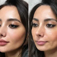 پایان جستجو کلینیک تخصصی پوست ژل 299نخ هایفوآموزش|خدمات آرایشگری و زیبایی|تهران, زعفرانیه|دیوار