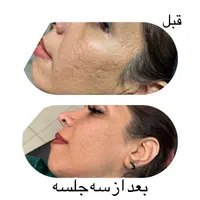 خدمات زیبایی مهرسیما|خدمات آرایشگری و زیبایی|اصفهان, جلفا|دیوار