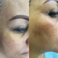 خدمات وآموزش پاکسازی پوست فیشیال فقط ویژه بانوان|خدمات آرایشگری و زیبایی|مشهد, طلاب|دیوار