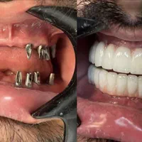 دندانپزشکی نقدواقساط باتخفیفات بینظیر فقط بمدت۷روز|خدمات آرایشگری و زیبایی|شیراز, ملاصدرا|دیوار