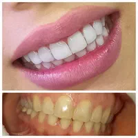 دندانپزشکی دیجیتال و طراحی لبخند اقساط|خدمات آرایشگری و زیبایی|رشت, دروازه لاکان|دیوار