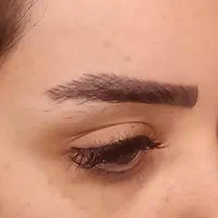 کاشت مو|خدمات آرایشگری و زیبایی|اصفهان, باغ زیار|دیوار