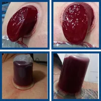 حجامت/بادکش/زالو/ناف گیر/درمنـزل شـما