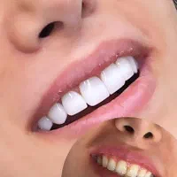 کامپوزیت دندان ، اصلاح طرح لبخند|خدمات آرایشگری و زیبایی|اصفهان, خواجو|دیوار