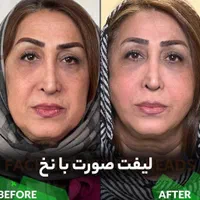 جشنواره مادلینگ و ژل لب و لیفت ابرو با نخ|خدمات آرایشگری و زیبایی|تهران, صادقیه|دیوار