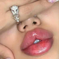 لیفت صورت/تزریق ژل/لیزر مو/جراحی پلک در کلینیک|خدمات آرایشگری و زیبایی|تهران, طرشت|دیوار