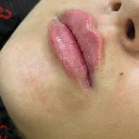 فیشیال vip با تخفیف ویژه|خدمات آرایشگری و زیبایی|مشهد, سناباد|دیوار