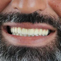مرکز تخصصی کاشت ایمپلنت