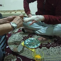 شکسته بندی ورگ گیری