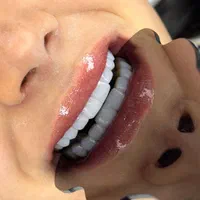 دندانپزشکی.کامپوزیت دندان .عصب کشی .لمینت.روکش|خدمات آرایشگری و زیبایی|تهران, تهرانپارس شرقی|دیوار