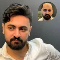 پروتز مو ، چسب پروتز ، ترمیم و تعویض چسب