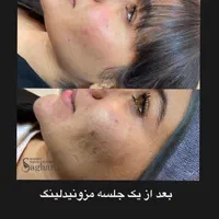۵۰ درصد تخفیف ویژه فیشال به مدت ۳ روز|خدمات آرایشگری و زیبایی|اهواز, کیانپارس |دیوار