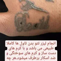 ریمو تتو و کربن تراپی|خدمات آرایشگری و زیبایی|سنندج, |دیوار