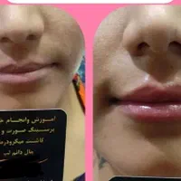 جشنواره آموزش پیرسینگ میکرو چال هیدن ژل بوتاکس ا|خدمات آرایشگری و زیبایی|مشهد, رضاشهر|دیوار