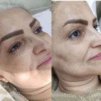 رفع تیرگی،جوانسازی و اوزون تراپی عفونت زنان|خدمات آرایشگری و زیبایی|تهران, افسریه|دیوار