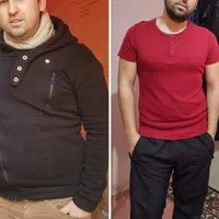 امبدینگ لاغری لیفت سینه وصورت با نخ|خدمات آرایشگری و زیبایی|قم, سالاریه|دیوار