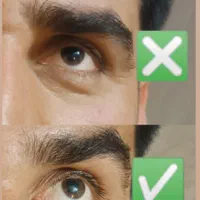 ژل و بوتاکس و آرایش دایم|خدمات آرایشگری و زیبایی|میبد, |دیوار