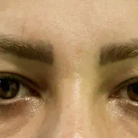 (شوش، شوشتر، اندیمشک) بلفاروپلاستی|خدمات آرایشگری و زیبایی|شوش, |دیوار