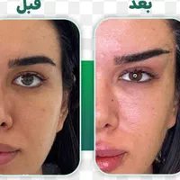 تخفیف ویژه تا ۶ شهریور  فیلربادی سینه بیکینی باسن|خدمات آرایشگری و زیبایی|تهران, دارآباد|دیوار