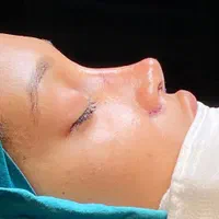 عمل جراحی زیبایی بینی اندام گوش لیفت صورت|خدمات آرایشگری و زیبایی|تهران, افسریه شمالی|دیوار