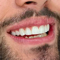مدل کامپوزیت دندان|خدمات آرایشگری و زیبایی|تهران, هاشمی|دیوار