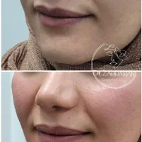 مرکز لیزر و زیبایی دکتر کیانی/ ژل بوتاکس مزو|خدمات آرایشگری و زیبایی|اهواز, کوروش|دیوار