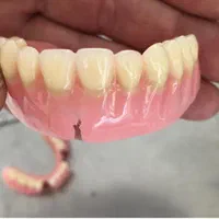 دندانپزشکی و دندان سازی خیریه چمران (جراحی. زیبایی|خدمات آرایشگری و زیبایی|تهران, امام حسین|دیوار